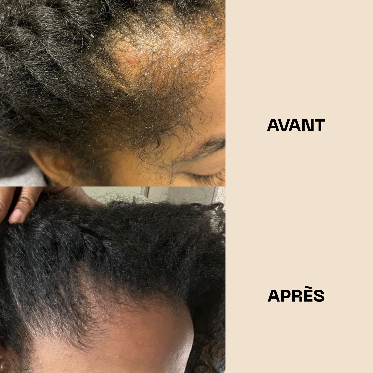 Huile de Batana pure – Pousse rapide et cheveux plus épais en 28 jours