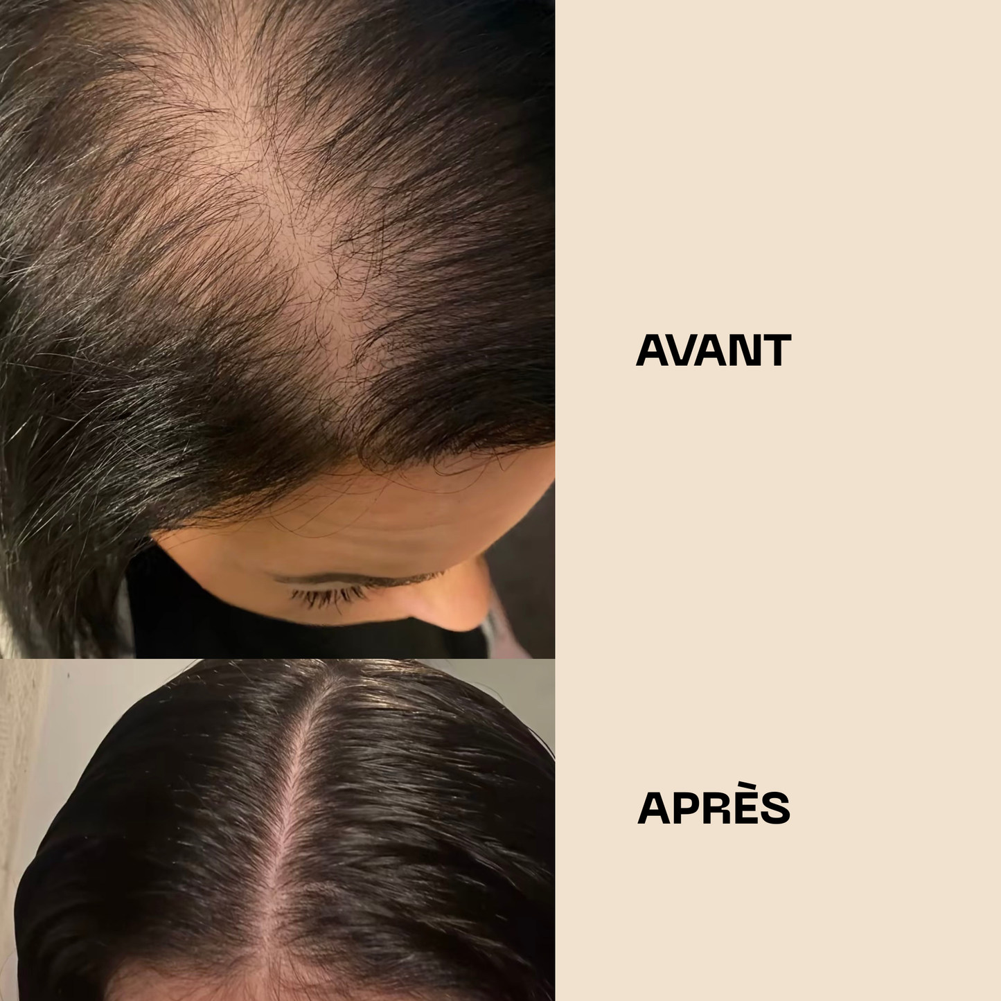 Huile de Batana pure – Pousse rapide et cheveux plus épais en 28 jours