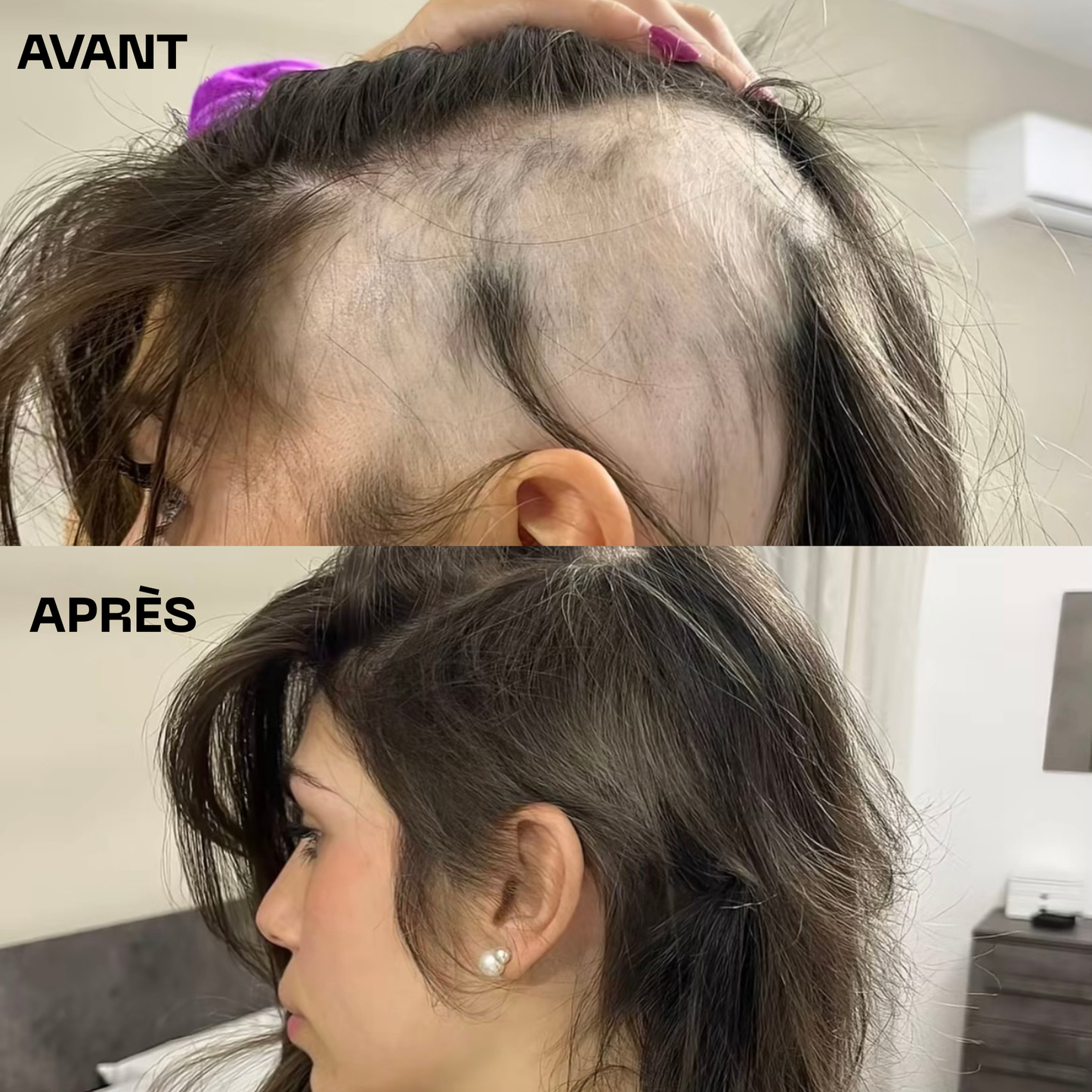 Huile de Batana pure – Pousse rapide et cheveux plus épais en 28 jours