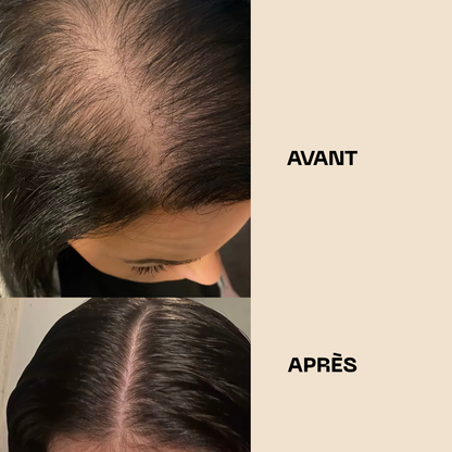 Huile de Batana pure – Pousse rapide et cheveux plus épais en 28 jours
